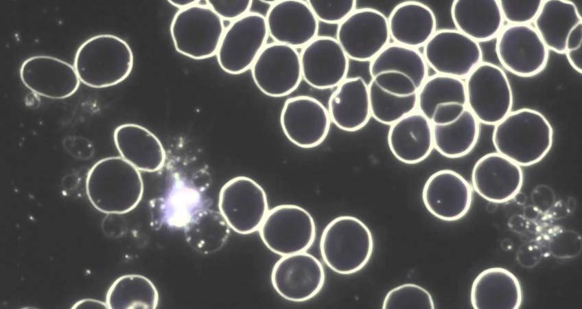 Microscopia in campo oscuro